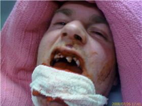 attempt to eat Thundercat at speed 