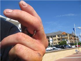 OUCH...... me mate caught the deckie on a charter thats a 60 through the middle of the nuckle joint.