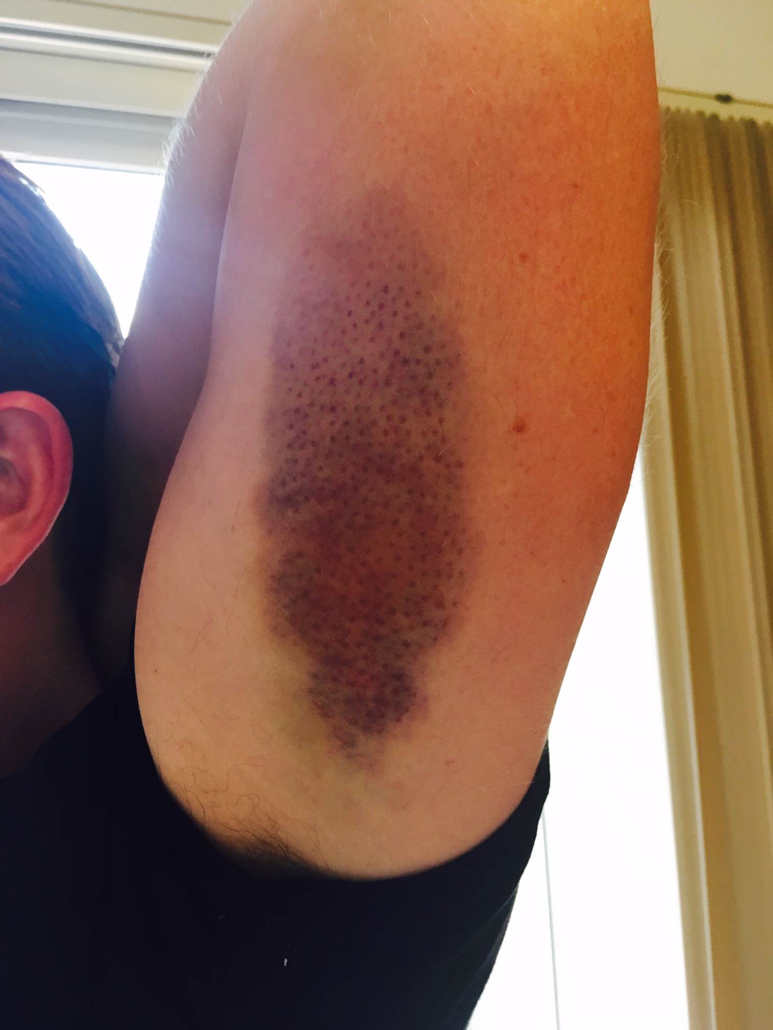 Unwanted quick release