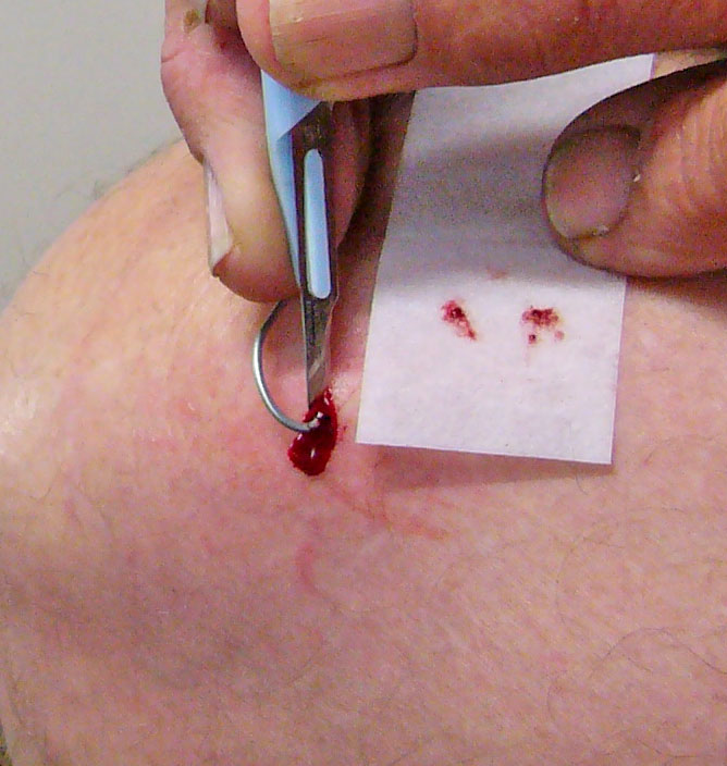 Don't stand up with your foot on the sinker!