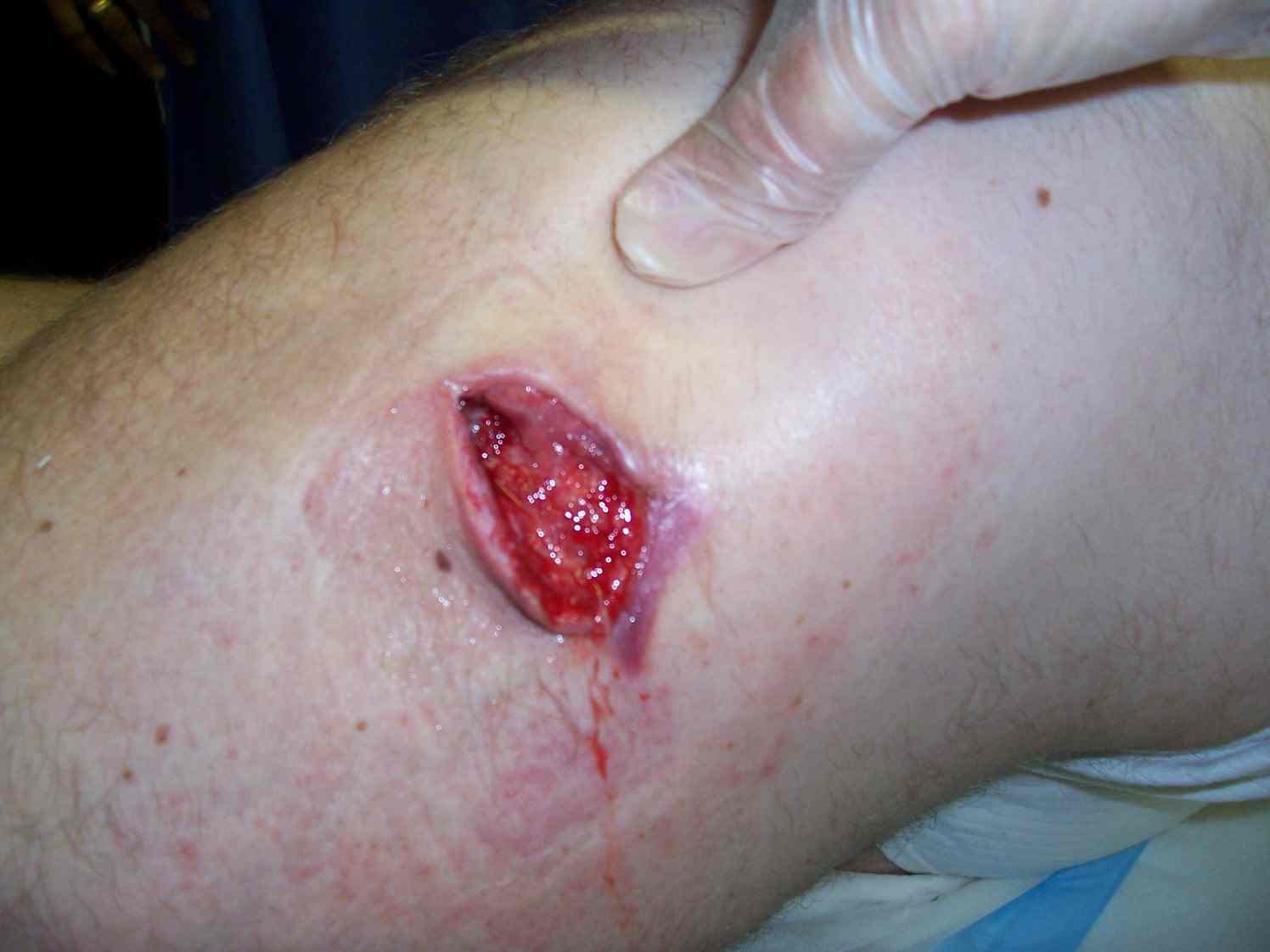 Original Stingray Hole