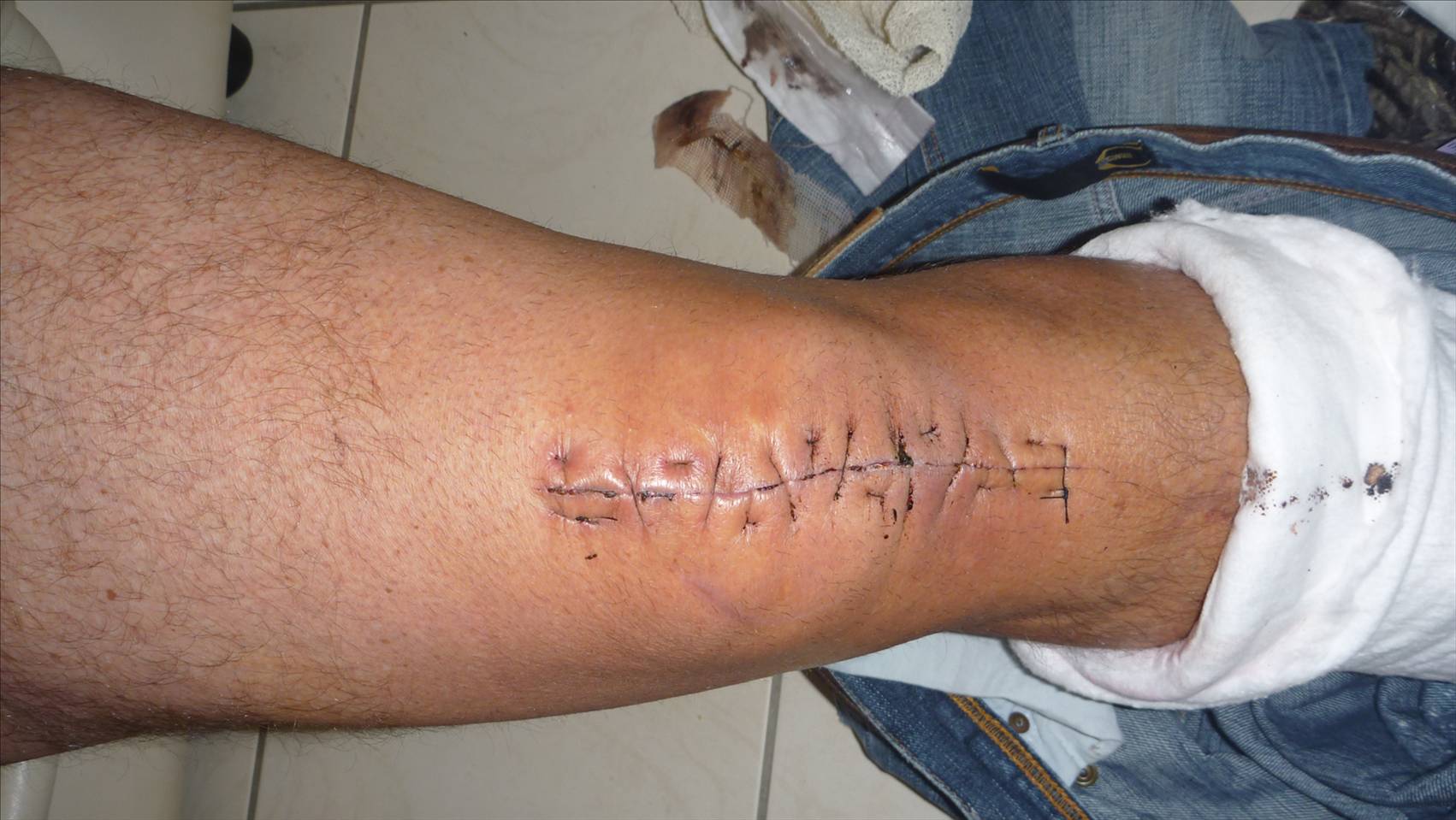 WInter gives recovery time for this shit