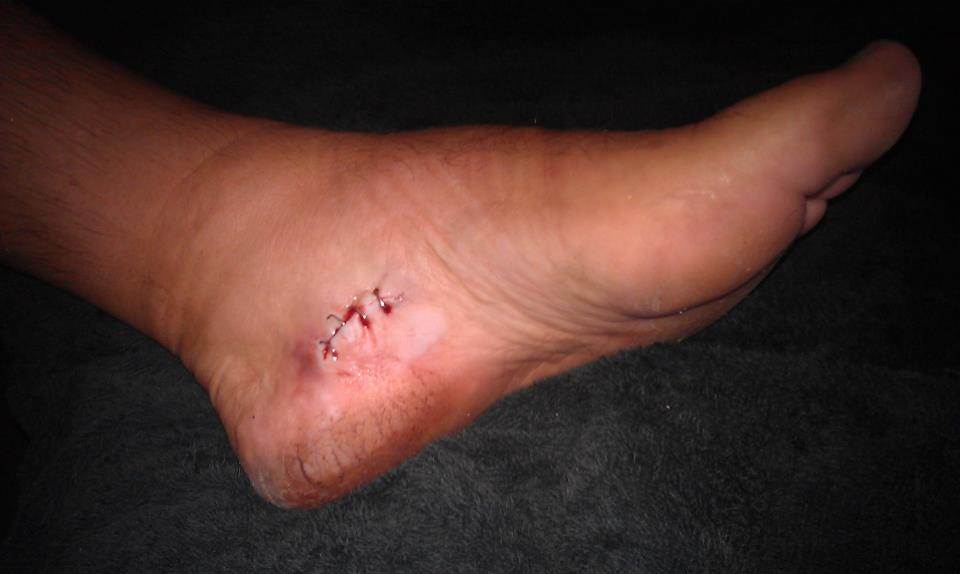 400112 340532492632161 1894025438 n