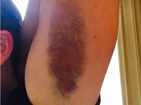 Unwanted quick release