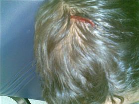 Leash Accident, The entrance