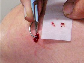 Don't stand up with your foot on the sinker!