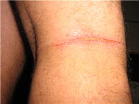 Legs vs lines!!  Not cool!!