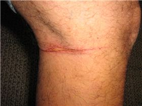 Legs vs lines!!  Not cool!!