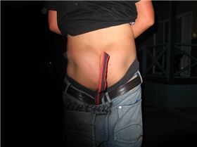 the infamous foot pads