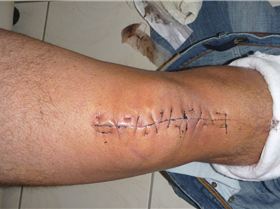 WInter gives recovery time for this shit