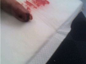 broke my nail kiting