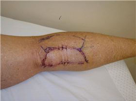 A shark bite would have been less life threatening