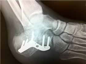 Luke Pics Feb 13 035