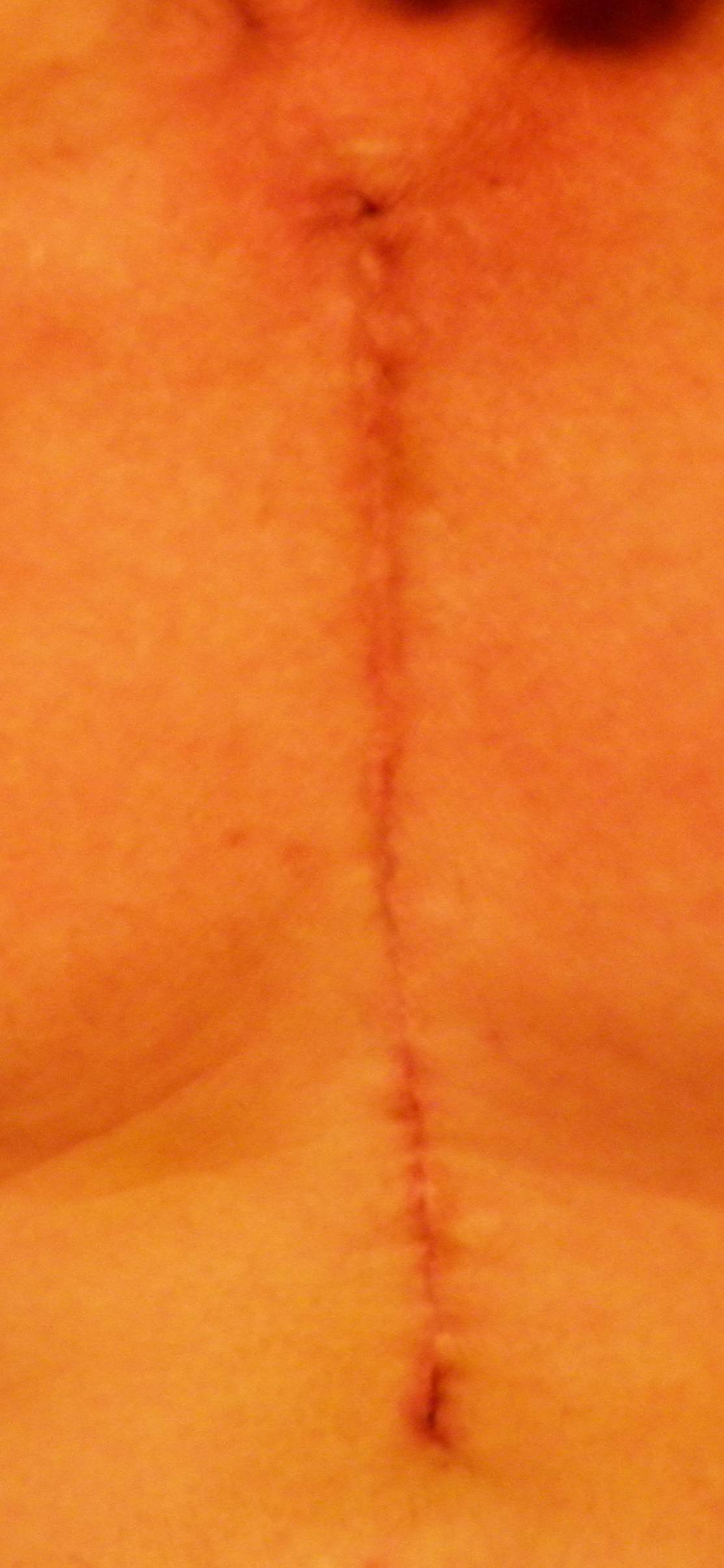 PB180290SplitBrisket