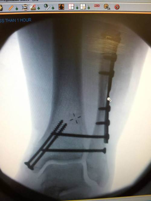 1002602 10151607517812914 1823653080 n