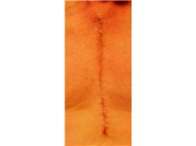 PB180290SplitBrisket