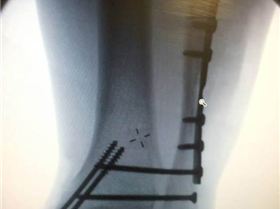 1002602 10151607517812914 1823653080 n