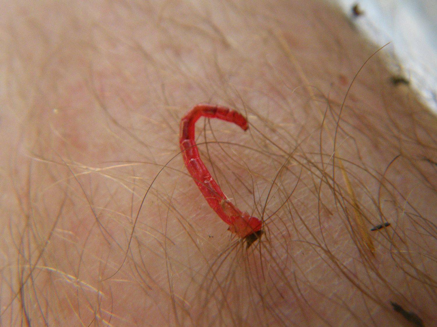 red worms crawling out of my skin