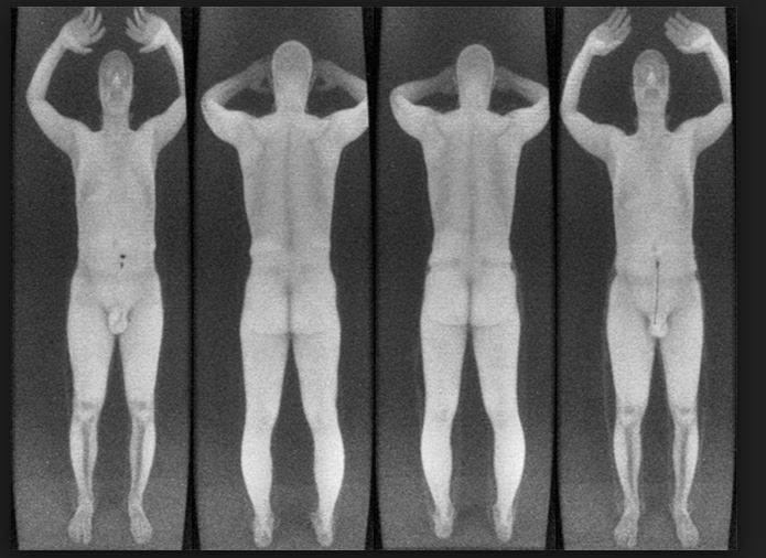 bodyscan