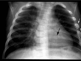 Best result for a theif