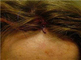 My contribution of accident pics