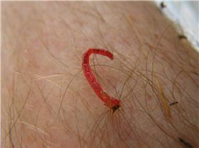 red worms crawling out of my skin