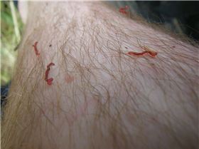 red worms crawling out of my skin