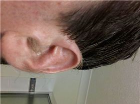 ear hair