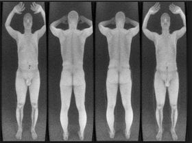 bodyscan