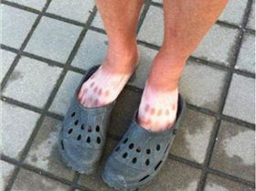 crocs