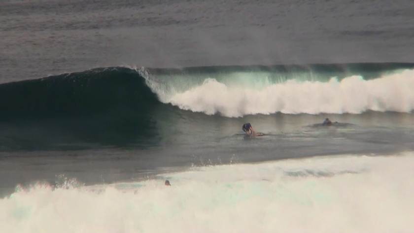 Every Standups Nightmare, The Overhead Cleanup Set