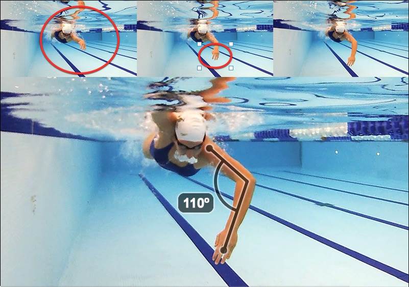 Becky's hand during stroke