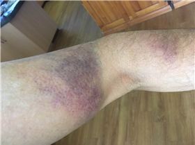 Not hard at all...or is it?