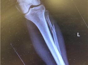 Screenshot15421459pm