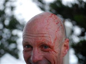 Al Bradley Hail Damage