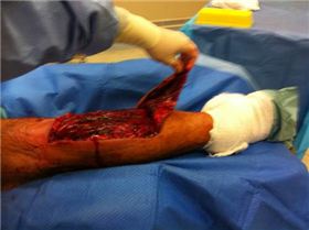 Leg before stitching small