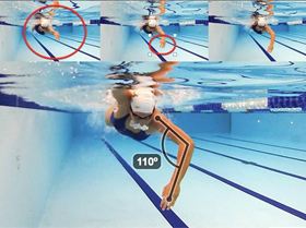 Becky's hand during stroke