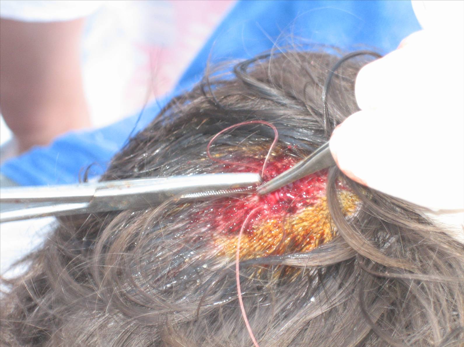 Louis melon @ Gnaraloo, April 08