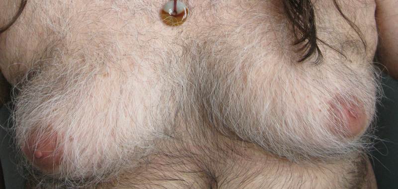 hairy man boobs
