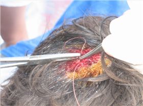 Louis melon @ Gnaraloo, April 08