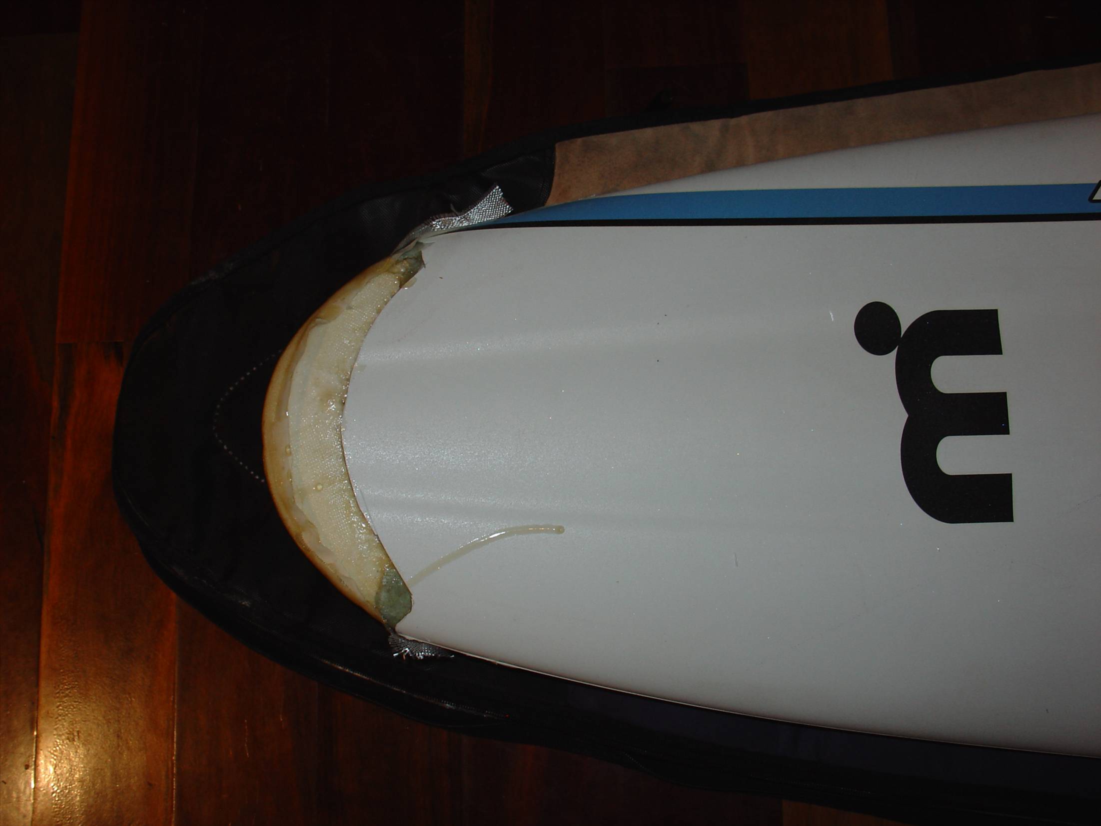 classic nose remodel 1