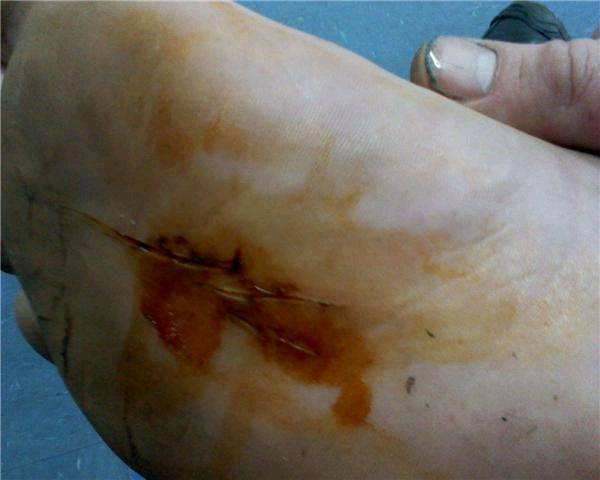 GetAttachment cv c v