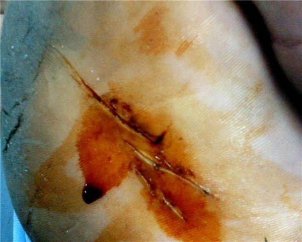 7121 1232386651134 1273187927 30664730 7073312 n