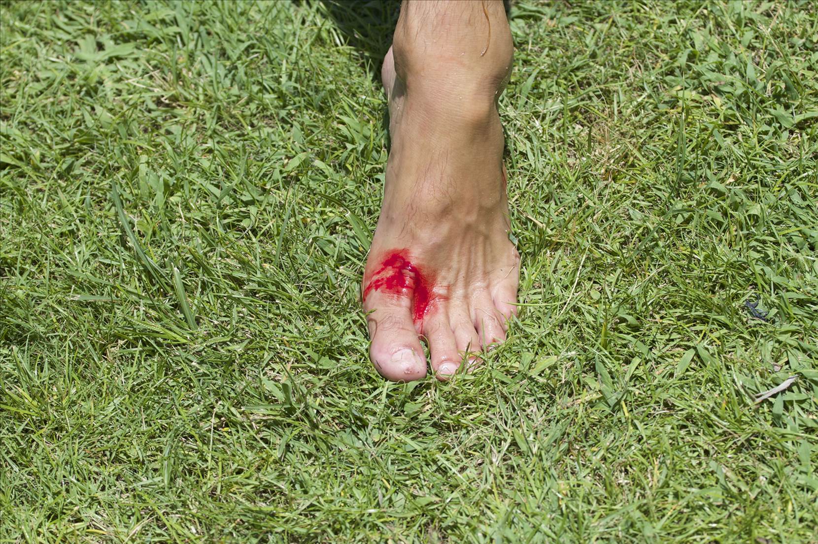 bloody foot