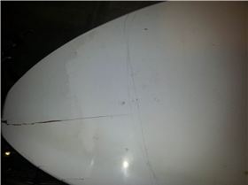 Posibble surgery line