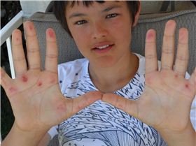 Coros action Jan 2014