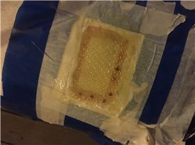 F2 Lightning foot plug repair