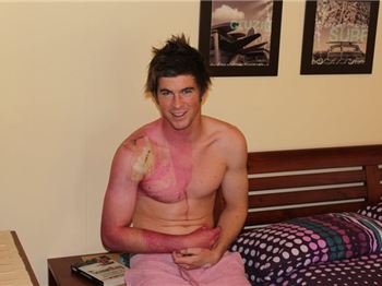 Kitesurfing world champ Andy Yates goes under the knife - Kitesurfing News